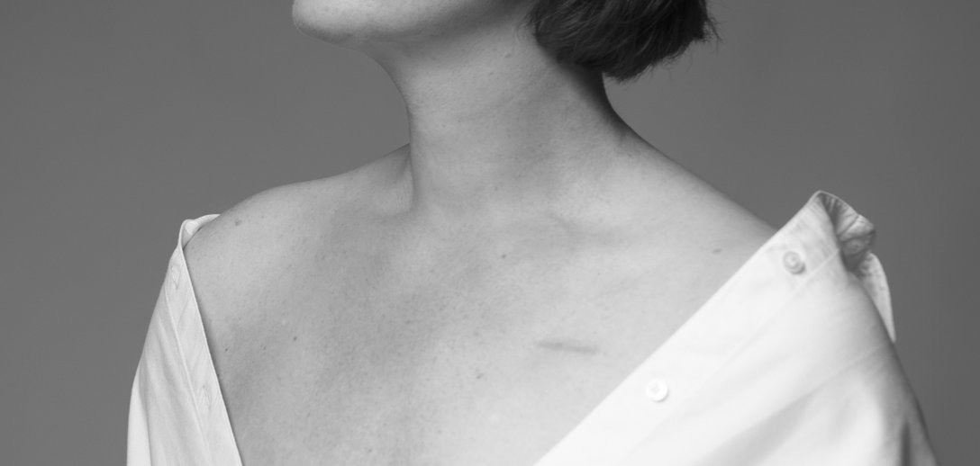 Fotografują Polki po mastektomii. Bo nie trzeba mieć piersi, żeby być kobietą!